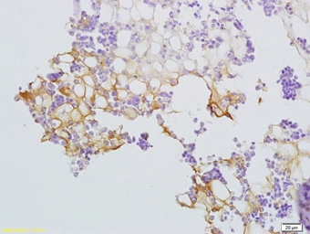 Anti-CD92 antibody used in IHC (Paraffin sections) (IHC-P). GTX51574