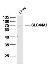 Anti-CD92 antibody used in Western Blot (WB). GTX51574