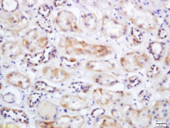 Anti-SLC25A10 antibody used in IHC (Paraffin sections) (IHC-P). GTX51583