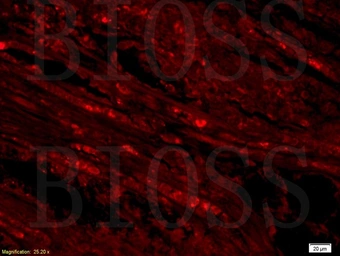 Anti-SLC25A10 antibody used in IHC (Paraffin sections) (IHC-P). GTX51583