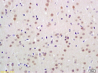 Anti-UBL7 antibody used in IHC (Paraffin sections) (IHC-P). GTX51584