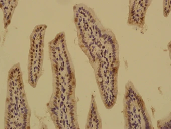 Anti-ASAP1 antibody used in IHC (Paraffin sections) (IHC-P). GTX51586