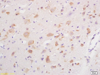 Anti-GABA A Receptor gamma 2 antibody used in IHC (Paraffin sections) (IHC-P). GTX51587
