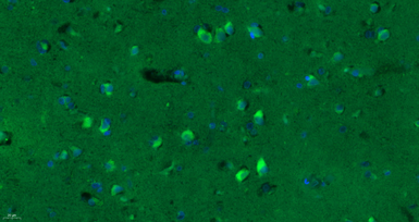 Anti-GABA A Receptor gamma 2 antibody used in IHC (Paraffin sections) (IHC-P). GTX51587
