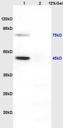 Anti-NP1 antibody used in Western Blot (WB). GTX51589
