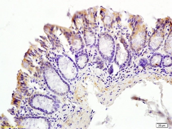Anti-SLC52A3 antibody used in IHC (Paraffin sections) (IHC-P). GTX51591