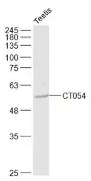 Anti-SLC52A3 antibody used in Western Blot (WB). GTX51591