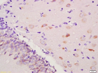 Anti-PGT antibody used in IHC (Paraffin sections) (IHC-P). GTX51606