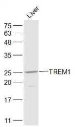 Anti-TREM1 antibody used in Western Blot (WB). GTX51612