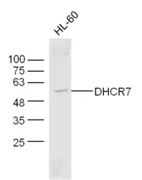 Anti-DHCR7 antibody used in Western Blot (WB). GTX51622