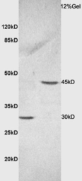 Anti-LASS2 antibody used in Western Blot (WB). GTX51624
