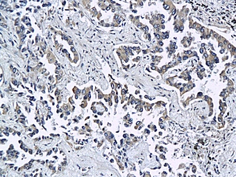 Anti-ESAM antibody used in IHC (Paraffin sections) (IHC-P). GTX51657