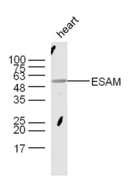 Anti-ESAM antibody used in Western Blot (WB). GTX51657