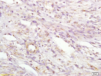 Anti-MIIP antibody used in IHC (Paraffin sections) (IHC-P). GTX51659