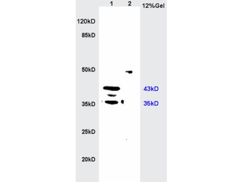 Anti-MIIP antibody used in Western Blot (WB). GTX51659