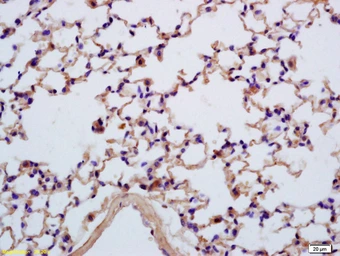 Anti-SEZ6L antibody used in IHC (Paraffin sections) (IHC-P). GTX51696