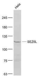 Anti-SEZ6L antibody used in Western Blot (WB). GTX51696