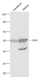 Anti-SVH antibody used in Western Blot (WB). GTX51744