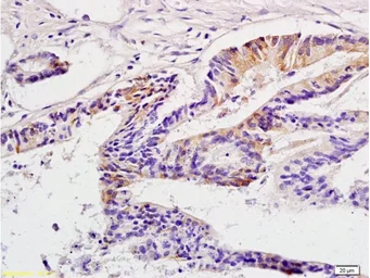 Anti-CTAG2 antibody used in IHC (Paraffin sections) (IHC-P). GTX51753