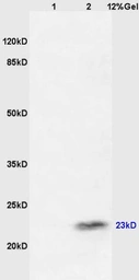 Anti-CTAG2 antibody used in Western Blot (WB). GTX51753