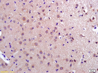 Anti-PDCD10 antibody used in IHC (Paraffin sections) (IHC-P). GTX51761