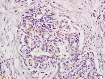 Anti-BOD1 antibody used in IHC (Paraffin sections) (IHC-P). GTX51766