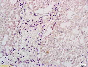 Anti-ELL2 antibody used in IHC (Paraffin sections) (IHC-P). GTX51778