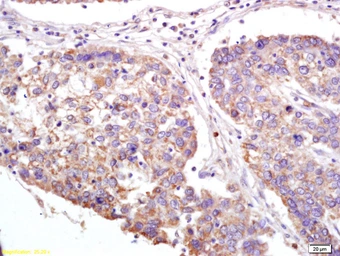 Anti-XAGE2 antibody used in IHC (Paraffin sections) (IHC-P). GTX51780
