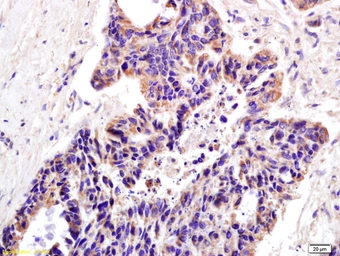 Anti-XAGE2 antibody used in IHC (Paraffin sections) (IHC-P). GTX51780