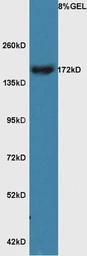 Anti-RERE antibody used in Western Blot (WB). GTX51787
