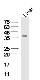 Anti-SIRT4 antibody used in Western Blot (WB). GTX51798