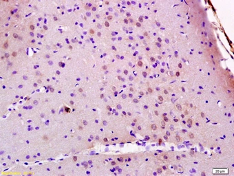 Anti-JMY antibody used in IHC (Paraffin sections) (IHC-P). GTX51804