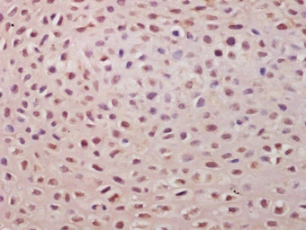 Anti-TSPYL5 antibody used in IHC (Paraffin sections) (IHC-P). GTX51813
