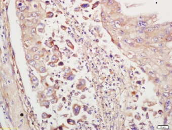Anti-TTK antibody used in IHC (Paraffin sections) (IHC-P). GTX51836