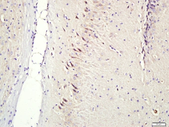 Anti-CNIH3 antibody used in IHC (Paraffin sections) (IHC-P). GTX51857