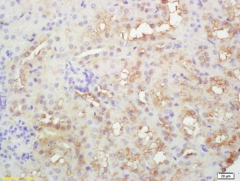 Anti-PLEKHM2 antibody used in IHC (Paraffin sections) (IHC-P). GTX51868