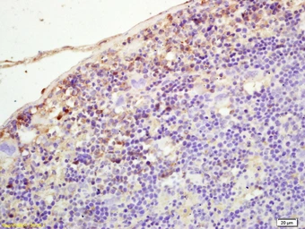 Anti-PLEKHM2 antibody used in IHC (Paraffin sections) (IHC-P). GTX51868