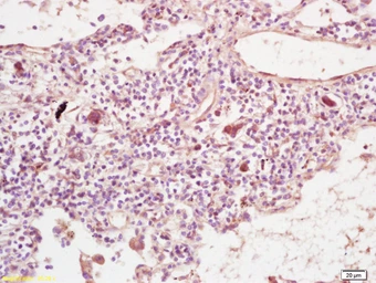 Anti-PLEKHM2 antibody used in IHC (Paraffin sections) (IHC-P). GTX51868