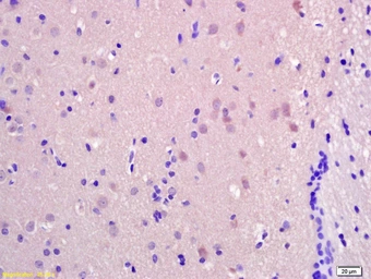 Anti-SRRM2 antibody used in IHC (Paraffin sections) (IHC-P). GTX51871