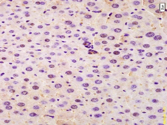 Anti-SRRM2 antibody used in IHC (Paraffin sections) (IHC-P). GTX51871