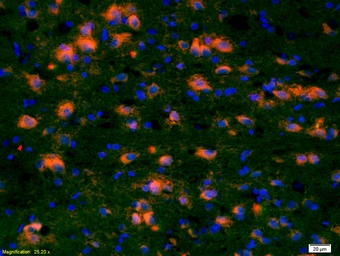 Anti-CCDC12 antibody used in IHC (Paraffin sections) (IHC-P). GTX51891