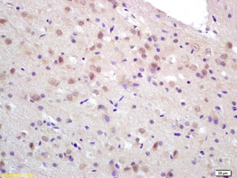 Anti-CCDC12 antibody used in IHC (Paraffin sections) (IHC-P). GTX51891