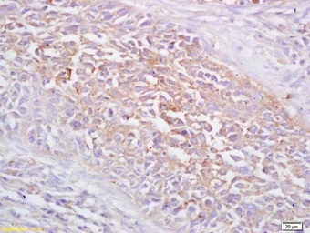 Anti-FRMD6 antibody used in IHC (Paraffin sections) (IHC-P). GTX51938