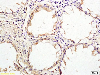 Anti-HHLA2 antibody used in IHC (Paraffin sections) (IHC-P). GTX51981