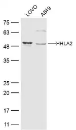 Anti-HHLA2 antibody used in Western Blot (WB). GTX51981
