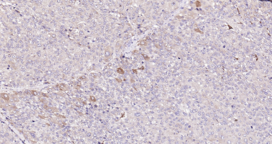 Anti-HHLA2 antibody used in IHC (Paraffin sections) (IHC-P). GTX51981