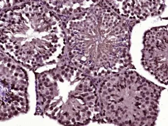 Anti-CDC14A antibody used in IHC (Paraffin sections) (IHC-P). GTX52005