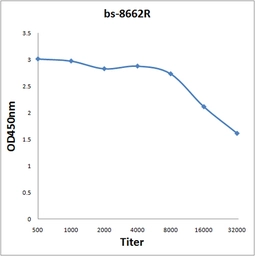 Anti-BASP1 antibody used in ELISA (ELISA). GTX52007