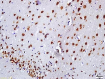 Anti-BASP1 antibody used in IHC (Paraffin sections) (IHC-P). GTX52007