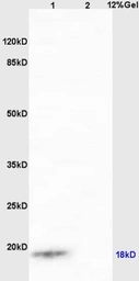 Anti-IQCJ antibody used in Western Blot (WB). GTX52020